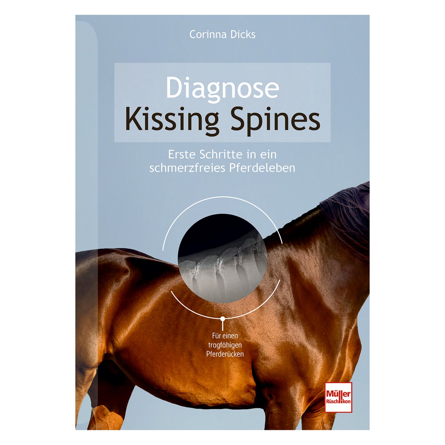 Diagnose Kissing Spines &ndash; Ansicht 1