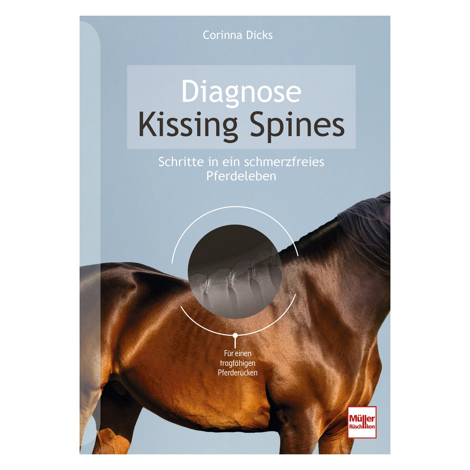 Müller Rüschlikon Diagnose Kissing Spines &ndash; Ansicht 1